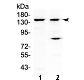 Western blot testing of 1) mouse liver and 2) human A431 lysate with FBXL11 antibody at 0.5ug/ml. Predicted molecular weight ~133 kDa.