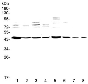 Western blot testing of 1) rat heart, 2) rat skeletal muscle, 3) rat brain, 4) rat kidney, 5) mouse heart, 6) mouse skeletal muscle, 7) mouse brain and 8) mouse kidney lysate with PDK2 antibody at 0.5ug/ml. Predicted molecular weight ~46 kDa.