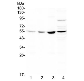 Western blot testing of rat 1) spleen, 2) thymus, 3) lung, 4) heart lysate with ICAM2 antibody at 0.5ug/ml. Expected molecular weight: 31-60 kDa depending on glycosylation level.