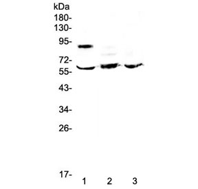 Western blot testing of human 1) placenta, 2) HepG2 and 3) MCF7 lysate with HSF2 antibody at 0.5ug/ml. Predicted molecular weight ~60 kDa.
