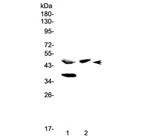 Western blot testing of 1) rat pancreas and 2) mouse pancreas lysate with Carboxypeptidase A antibody at 0.5ug/ml. Predicted molecular weight ~47 kDa.