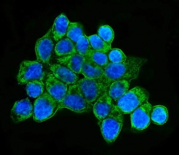 Immunofluorescent staining of FFPE human MCF7 cells with HLA-DQB1 antibody (green) and DAPI nuclear stain (blue). HIER: steam section in pH6 citrate buffer for 20 min.