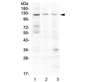 Western blot testing of 1) human COLO320, 2) mouse pancreas and 3) mouse lung lysate with TLR3 antibody at 0.5ug/ml. Predicted molecular weight ~104 kDa, observed here at ~120 kDa.