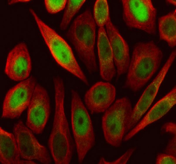 Immunofluorescent staining of FFPE human SiHa cells with SKP2 antibody (green) and Alpha Tubulin mAb (red). HIER: steam section in pH6 citrate buffer for 20 min.
