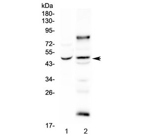 Western blot testing of human 1) SGC-7901 and 2) SK-OV-3 cell lysate with SKP2 antibody at 0.5ug/ml. Predicted molecular weight ~48 kDa.
