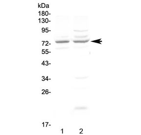 Western blot testing of human 1) COLO320 and 2) U-87 MG cell lysate with CHM antibody at 0.5ug/ml. Predicted molecular weight ~73 kDa.
