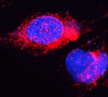 Immunofluorescent staining of FFPE human U-2 OS cells with DYRK1A antibody (red) and DAPI nuclear stain (blue). HIER: steam section in pH6 citrate buffer for 20 min.