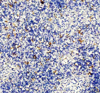 IHC staining of FFPE human spleen tissue with DC-SIGN antibody, HRP-secondary and DAB substrate. HIER: boil tissue sections in pH8 EDTA for 20 min and allow to cool before testing.