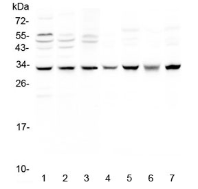 Western blot testing of 1) human MCF7, 2) A549, 3) SGC-7901, 4) rat brain, 5) rat heart, 6) mouse brain and 7) mouse heart lysate with SDHB antibody at 0.5ug/ml. Predicted molecular weight ~32 kDa.