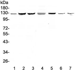 Western blot testing of human 1) HeLa, 2) HepG2, 3) PANC-1, 4) SK-OV-3, 5) COLO320, 6) rat testis and 7) mouse testis tissue with SMC6 antibody at 0.5ug/ml. Predicted molecular weight ~126 kDa.
