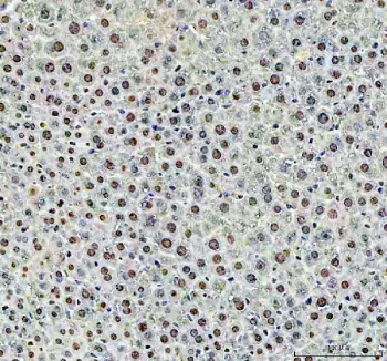 IHC staining of FFPE mouse liver tissue with DCK antibody. HIER: boil tissue sections in pH8 EDTA for 20 min and allow to cool before testing.