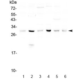 Western blot testing of 1) mouse spleen, 2) mouse thymus and human 3) HeLa, 4) U-87 MG, 5) MCF7 and 6) U-2 OS lysate with DCK antibody at 0.5ug/ml. Predicted molecular weight ~30 kDa. 