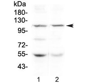 Western blot testing of human 1) HeLa and 2) SW620 lysate with DPYD antibody at 0.5ug/ml. Predicted molecular weight ~111 kDa.