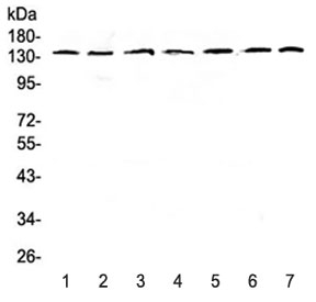 Western blot testing of human 1) HeLa, 2) COLO320, 3) A549, 4) SK-OV-3, 5) A431, 6) rat brain and 7) mouse brain lysate with PERK antibody at 0.5ug/ml. Predicted molecular weight ~125 kDa, observed here at ~140 kDa.