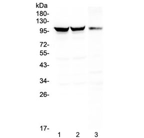 Western blot testing of 1) rat brain, 2) mouse brain and 3) mouse NIH3T3 lysate with Dynamin 1 antibody at 0.5ug/ml. Predicted molecular weight ~97 kDa.