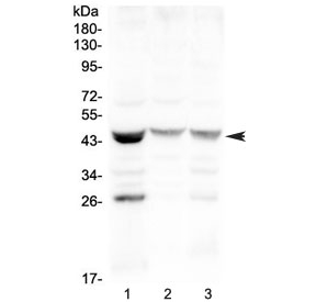 Western blot testing of human 1) MCF7, 2) COLO320 and 3) HepG2 cell lysate with SFTPB antibody at 0.5ug/ml. Predicted molecular weight ~42 kDa.