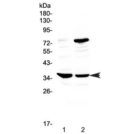 Western blot testing of rat 1) spleen and 2) thymus tissue with CD23 antibody at 0.5ug/ml. Expected molecular weight: 37-45 kDa.
