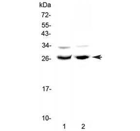 Western blot testing of 1) rat testis and 2) mouse ovary lysate with MAD antibody at 0.5ug/ml. Predicted molecular weight ~25 kDa.
