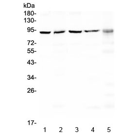 Western blot testing of human 1) HeLa, 2) A549, 3) 293T, 4) MCF7 and 5) 22RV1 cell lysate with PRDM1 / BLIMP1 antibody at 0.5ug/ml. Predicted molecular weight: ~92 kDa.
