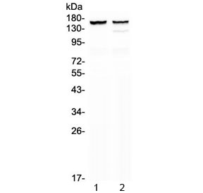 Western blot testing of 1) rat heart and 2) mouse heart lysate with MYBPC3 antibody at 0.5ug/ml. Predicted molecular weight ~147 kDa.