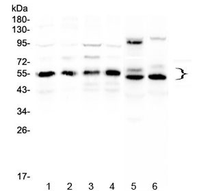 Western blot testing of human 1) HeLa, 2) COLO320, 3) A431, 4) MCF7, 5) rat heart and 6) mouse heart lysate with RXRA antibody at 0.5ug/ml. Predicted molecular weight: ~51 kDa but routinely observed at 54~60 kDa.