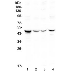 Western blot testing of human 1) HeLa 2) COLO320, 3) SW620 and 4) HepG2 lysate with Caspase 4 antibody at 0.5ug/ml. Expected molecular weight ~43 kDa (precursor), ~30 kDa (pro domain + large subunit), ~20 kDa (large subunit).