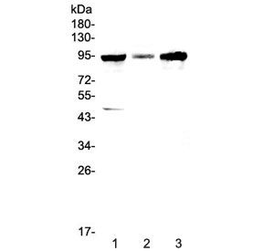 Western blot testing of human 1) HepG2, 2) PANC-1 and 3) SGC-7901 cell lysate with GNS antibody at 0.5ug/ml. Predicted molecular weight ~62 kDa, can be observed at ~94 kDa.