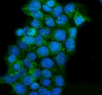 Immunofluorescent staining of FFPE human MCF7 cells with CLPP antibody (green) and DAPI nuclear stain (blue). HIER: steam section in pH6 citrate buffer for 20 min.