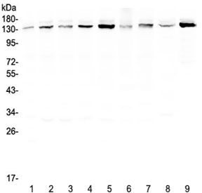 Western blot testing of human 1) HeLa, 2) 22RV1, 3) A431, 4) HepG2, 5) HepG2, 6) SGC-7901, 7) A549, 8) rat brain and 9) mouse testis lysate with USP7 antibody at 0.5ug/ml. Predicted molecular weight ~128 kDa, observed at ~135 kDa.