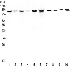 Western blot testing of human 1) HeLa, 2) placenta, 3) COLO-320, 4) HepG2, 5) SGC-7901, 6) Jurkat, 7) rat stomach, 8) mouse skeletal muscle, 9) mouse stomach and 10) mouse brain lysate with IDE antibody at 0.5ug/ml. Predicted molecular weight ~118 kDa.