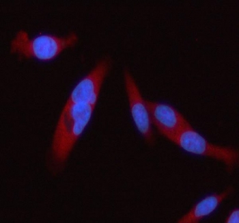 Western blot testing of 1) rat brain and 2) mouse brain lysate with STAT2 antibody at 0.5ug/ml. Expected molecular weight: 98-113 kDa depending on phosphorylation level.