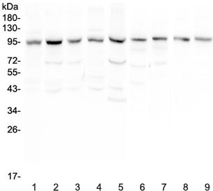 Western blot testing of human 1) HeLa, 2) placenta, 3) HepG2, 4) SGC-7901, 5) 22RV1, 6) rat lung, 7) mouse lung, 8) mouse testis and 9) mouse ovary with RALBP1 antibody at 0.5ug/ml. Predicted molecular weight ~76 kDa, observed molecular weight: 90-95 kDa.