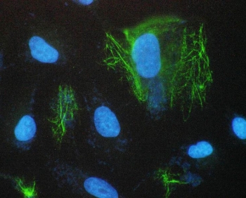 Immunofluorescent staining of FFPE human A431 cells with SCNN1A antibody (green) and DAPI nuclear stain (blue). HIER: steam section in pH6 citrate buffer for 20 min.