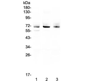 Western blot testing of human 1) A549, 2) SGC-7901 and 3) U-2 OS cell lysate with Bestrophin 1 antibody at 0.5ug/ml. Predicted molecular weight ~68 kDa.