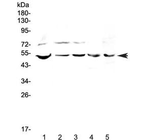 Western blot testing of human 1) PANC-1, 2) 22RV1, 3) COLO-320, 4) SW620 and 5) mouse SP20 lysate with ESRRG antibody at 0.5ug/ml. Predicted molecular weight ~51 kDa.