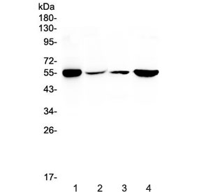 Western blot testing of human 1) HeLa, 2) HepG2, 3) A549 and 4) 22RV1 cell lysate with Glutathione Reductase antibody at 0.5ug/ml. Predicted molecular weight ~55 kDa.