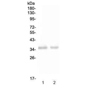 Western blot testing of 1) rat spleen and 2) mouse spleen with NKp46 antibody at 0.5ug/ml. Expected molecular weight: 34-46 kDa depending on glycosylation level.