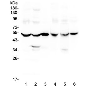 Western blot testing of rat 1) brain, 2) liver, 3) small intestine and mouse 4) brain, 5) liver and 6) small intestine lysate with GDA antibody at 0.5ug/ml. Predicted molecular weight ~51 kDa.