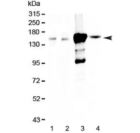 Western blot testing of 1) rat kidney, 2) mouse kidney, 3) human 293T and 4) human HK-2 lysate with Periaxin antibody at 0.5ug/ml. Predicted molecular weight ~155 kDa.