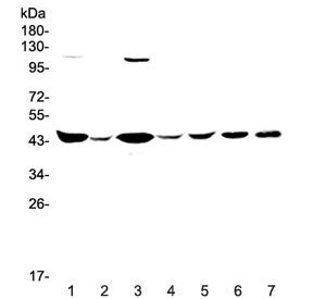 Western blot testing of human 1) HeLa, 2) placenta, 3) COLO-320, 4) SW620, 5) MDA-MB-231, 6) rat brain and 7) mouse brain lysate with CKB antibody at 0.5ug/ml. Predicted molecular weight ~43 kDa.