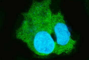 Immunofluorescent staining of FFPE human HepG2 cells with Carboxylesterase 1 antibody (green) and DAPI nuclear stain (blue). HIER: steam section in pH6 citrate buffer for 20 min.