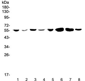 Western blot testing of human 1) Jurkat, 2) HepG2, 3) MCF7, 4) U-87 MG, 5) CCRF-CEM, 6) rat brain, 7) mouse brain and 8) mouse testis lysate wtih CCR3 antibody at 0.5ug/ml. Expected molecular weight: 40~55 kDa.