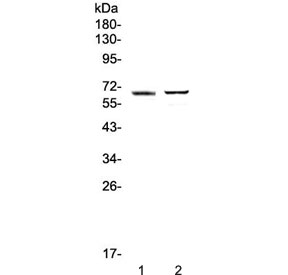 Western blot testing of 1) human placenta and 2) mouse testis lysate with RUNX1T1 antibody at 0.5ug/ml. Predicted molecular weight ~67 kDa.