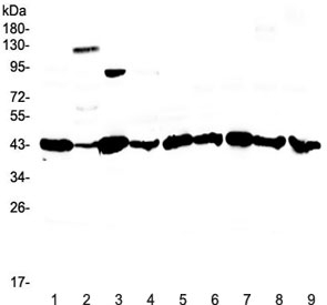 Western blot testing of rat 1) liver, 2) testis, 3) stomach, 4) thymus and human 5) COLO-320, 6) HepG2, 7) 22RV1, 8) PANC-1 and 9) SGC-7901 lysate with Caspase 4 antibody at 0.5ug/ml. Expected molecular weight ~43 kDa (precursor), ~30 kDa (pro domain + large subunit), ~20 kDa (large subunit).
