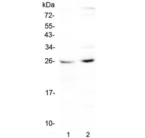 Western blot testing of human 1) HepG2 and 2) PANC-1 cell lysate with CTR1 antibody at 0.5ug/ml. Expected molecular weight ~25 kDa (unmodified), 35-37 kDa (glycosylated).