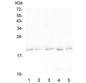 Western blot testing of mouse 1) spleen, 2) thymus, 3) lung, 4) testis and 5) NIH 3T3 lysate with BCMA antibody at 0.5ug/ml. Expected molecular weight: 20-27 kDa depending on glycosylation level.