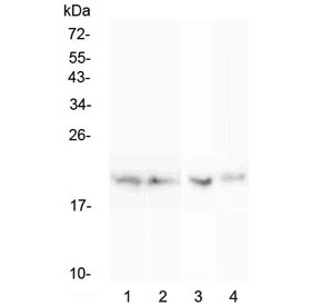 Western blot testing of rat 1) spleen, 2) thymus, 3) lung and 4) testis lysate with BCMA antibody at 0.5ug/ml. Expected molecular weight: 20-27 kDa depending on glycosylation level.