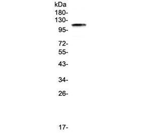 Western blot testing of human HeLa cell lysate with BCMA antibody at 0.5ug/ml. Expected molecular weight: 96-110 kDa.