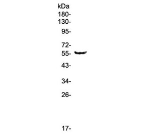 Western blot testing of human A375 cell lysate with TRIM5 antibody at 0.5ug/ml. Predicted molecular weight ~56 kDa.