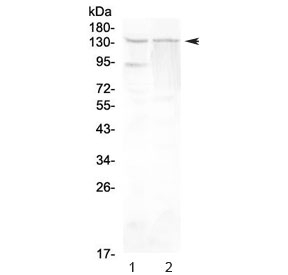 Western blot testing of rat 1) testis and 2) PC-12 lysate with RTEL1 antibody at 0.5ug/ml. Predicted molecular weight ~134 kDa.